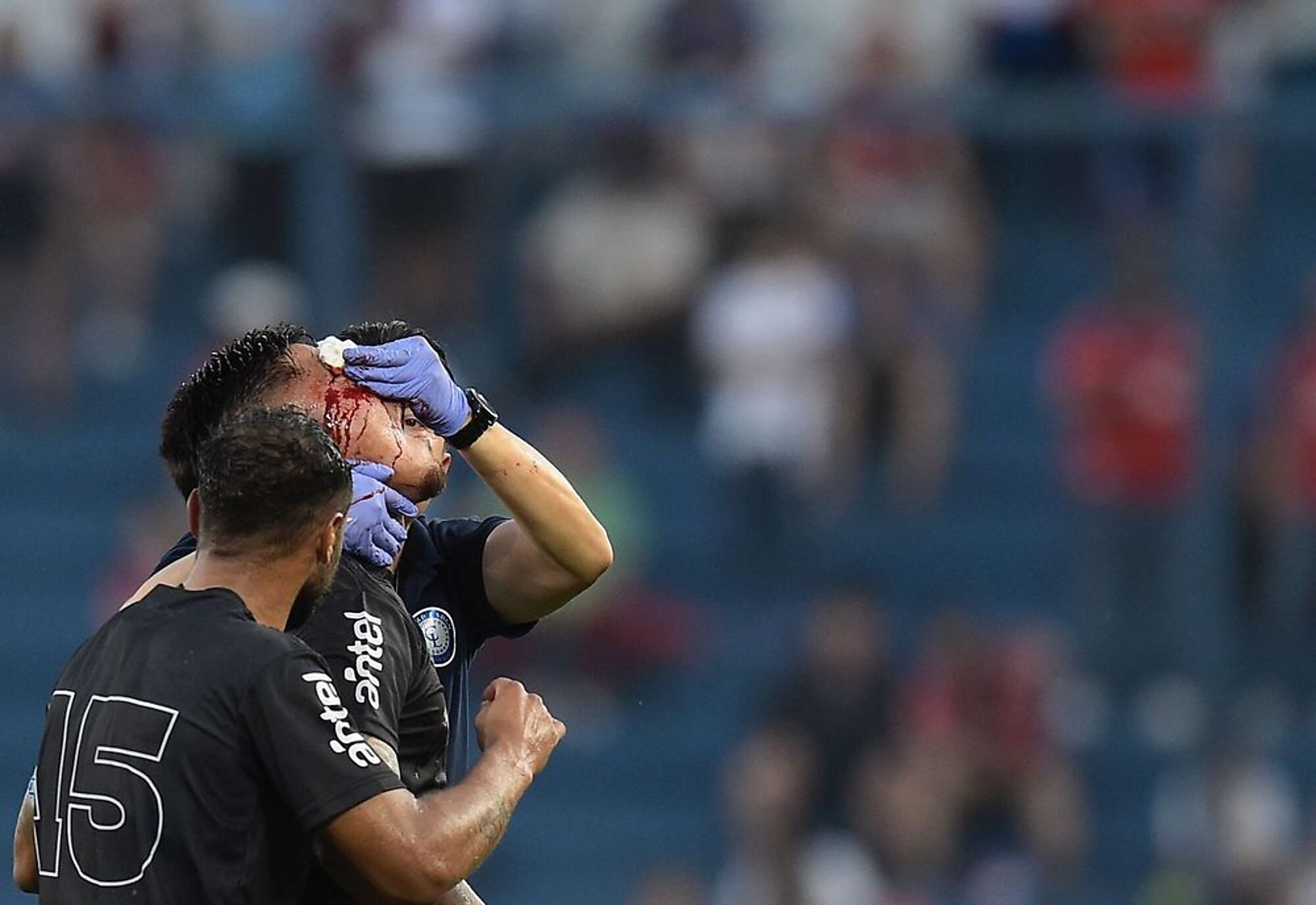Así salió Mauro Brasil tras el choque con Ebere Así salió Mauro Brasil tras el choque con Ebere